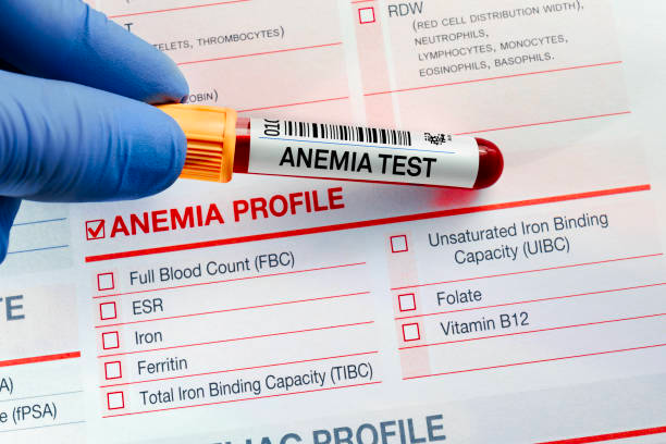 Medicori.ru | Федеральные клинические рекомендации по лечению железодефицитной анемии